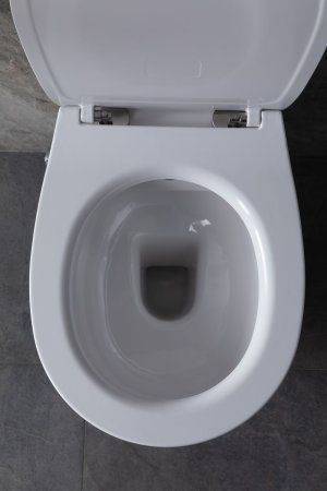 Крышка-сиденье для унитаза Allen Brau Fantasy Smartfix, Soft-Close 4.11005.20 белый глянец