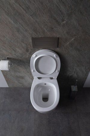 Крышка-сиденье для унитаза Allen Brau Fantasy Smartfix, Soft-Close 4.11005.20 белый глянец